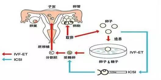 北京试管移植